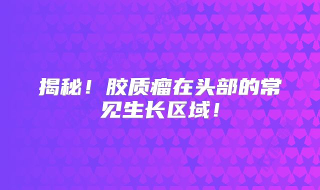 揭秘！胶质瘤在头部的常见生长区域！