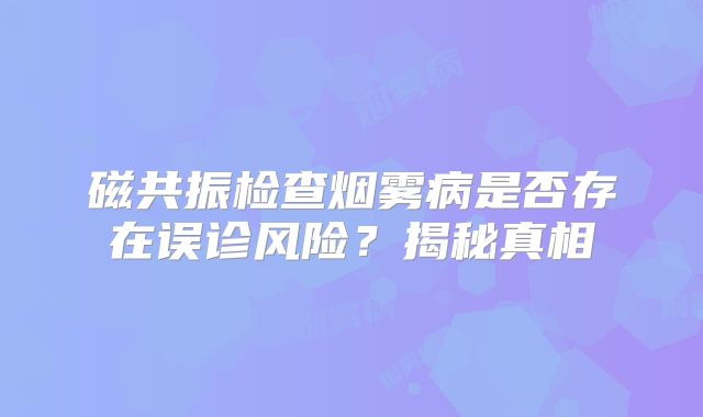 磁共振检查烟雾病是否存在误诊风险？揭秘真相