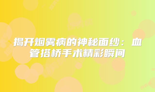 揭开烟雾病的神秘面纱：血管搭桥手术精彩瞬间