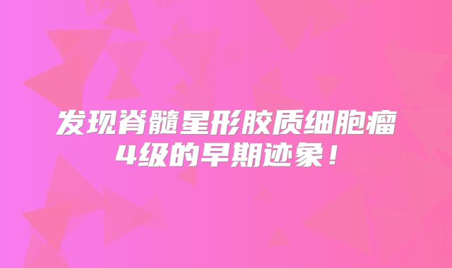 发现脊髓星形胶质细胞瘤4级的早期迹象！