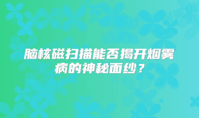 脑核磁扫描能否揭开烟雾病的神秘面纱？