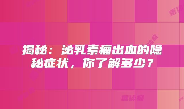 揭秘：泌乳素瘤出血的隐秘症状，你了解多少？