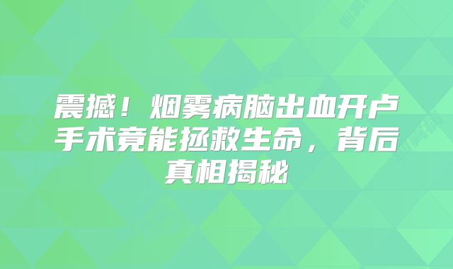 震撼！烟雾病脑出血开卢手术竟能拯救生命，背后真相揭秘