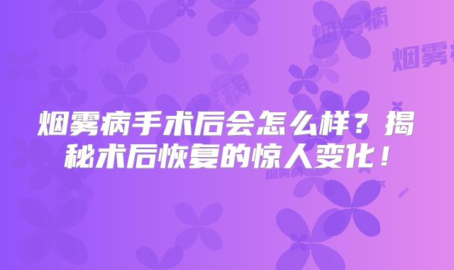 烟雾病手术后会怎么样？揭秘术后恢复的惊人变化！