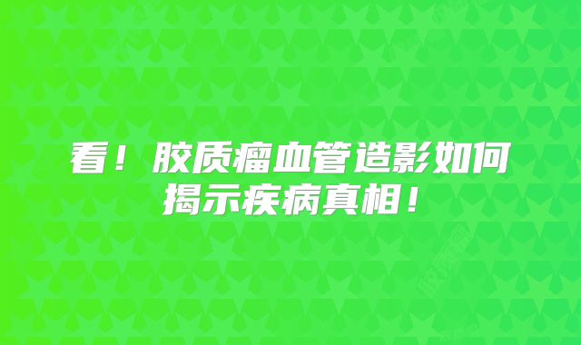 看！胶质瘤血管造影如何揭示疾病真相！
