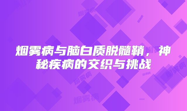 烟雾病与脑白质脱髓鞘，神秘疾病的交织与挑战