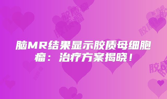 脑MR结果显示胶质母细胞瘤：治疗方案揭晓！