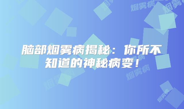 脑部烟雾病揭秘：你所不知道的神秘病变！