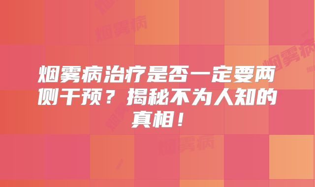 烟雾病治疗是否一定要两侧干预？揭秘不为人知的真相！
