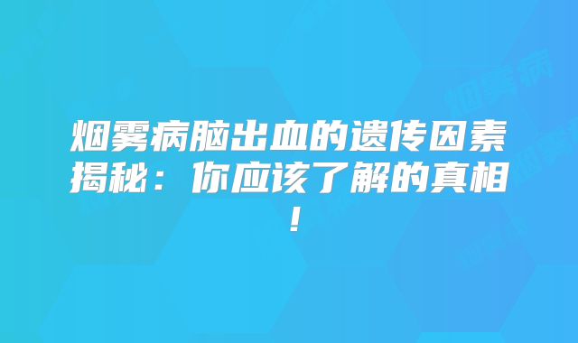 烟雾病脑出血的遗传因素揭秘：你应该了解的真相！