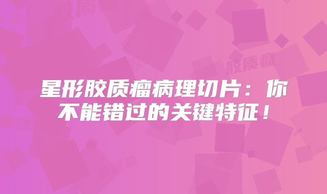 星形胶质瘤病理切片：你不能错过的关键特征！