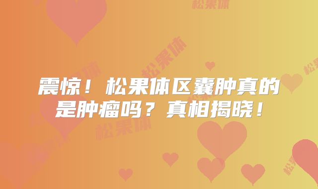 震惊！松果体区囊肿真的是肿瘤吗？真相揭晓！