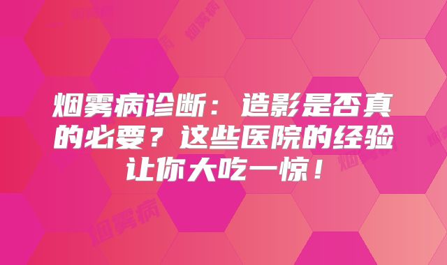 烟雾病诊断：造影是否真的必要？这些医院的经验让你大吃一惊！