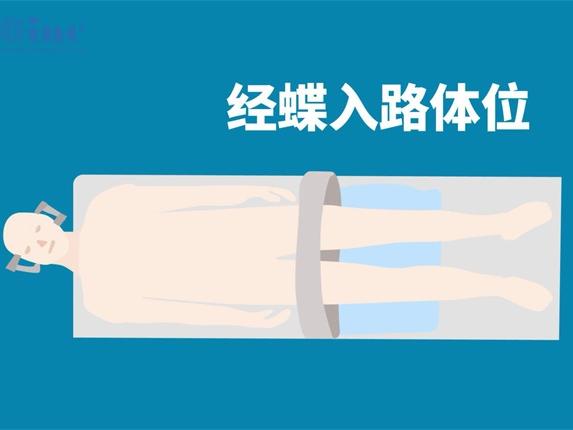 胶质母细胞瘤复发后，放疗能否延长生命？