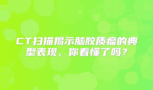 CT扫描揭示脑胶质瘤的典型表现，你看懂了吗？