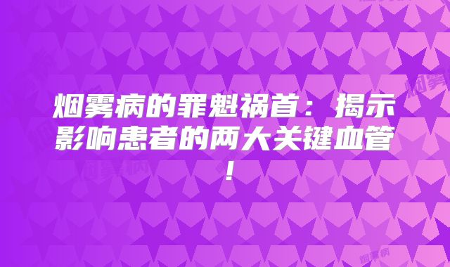 烟雾病的罪魁祸首：揭示影响患者的两大关键血管！