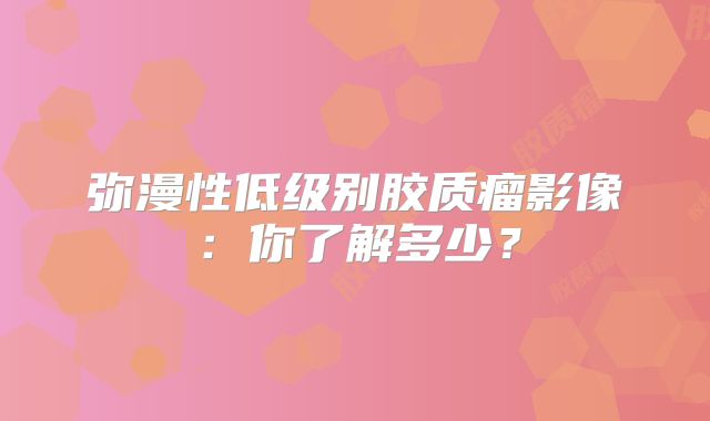 弥漫性低级别胶质瘤影像：你了解多少？