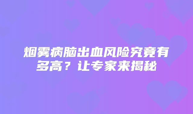 烟雾病脑出血风险究竟有多高？让专家来揭秘