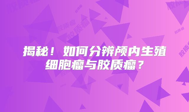 揭秘！如何分辨颅内生殖细胞瘤与胶质瘤？