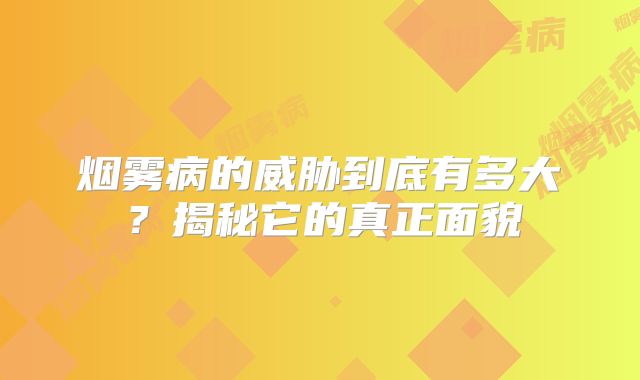 烟雾病的威胁到底有多大？揭秘它的真正面貌