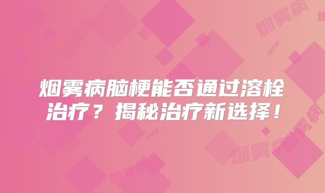 烟雾病脑梗能否通过溶栓治疗？揭秘治疗新选择！