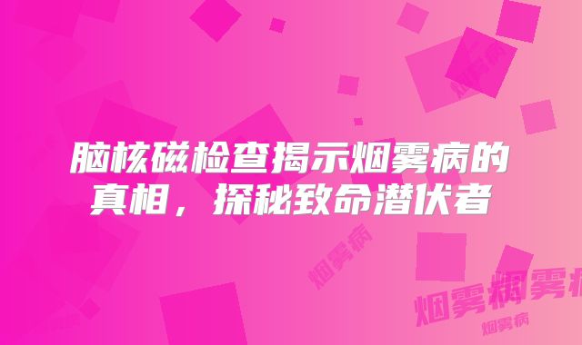 脑核磁检查揭示烟雾病的真相，探秘致命潜伏者