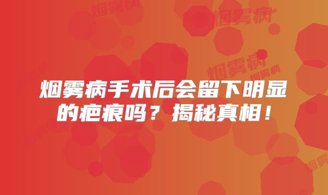 烟雾病手术后会留下明显的疤痕吗？揭秘真相！
