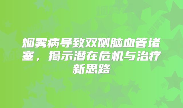 烟雾病导致双侧脑血管堵塞，揭示潜在危机与治疗新思路