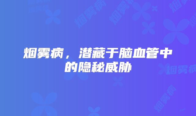 烟雾病，潜藏于脑血管中的隐秘威胁