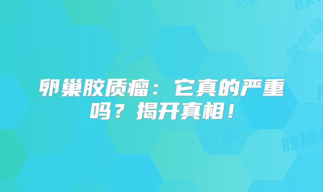 卵巢胶质瘤：它真的严重吗？揭开真相！