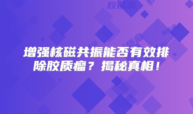 增强核磁共振能否有效排除胶质瘤？揭秘真相！