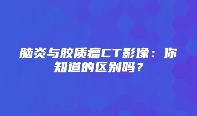 脑炎与胶质瘤CT影像：你知道的区别吗？
