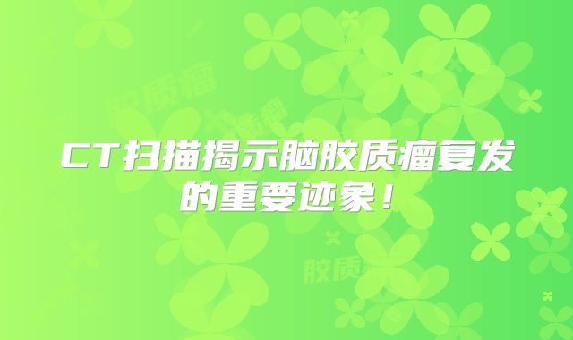 CT扫描揭示脑胶质瘤复发的重要迹象！