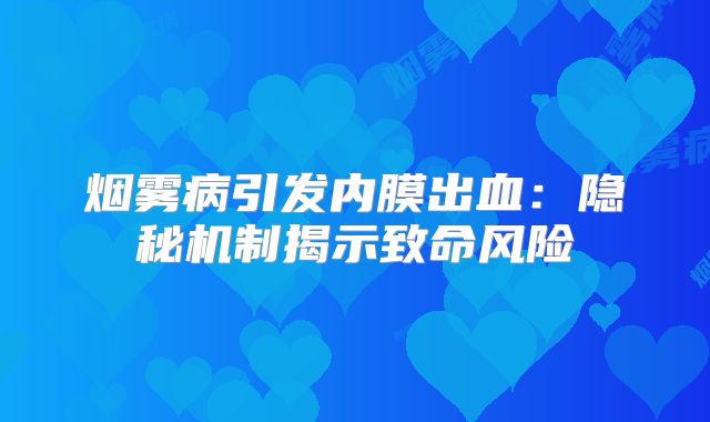 烟雾病引发内膜出血：隐秘机制揭示致命风险