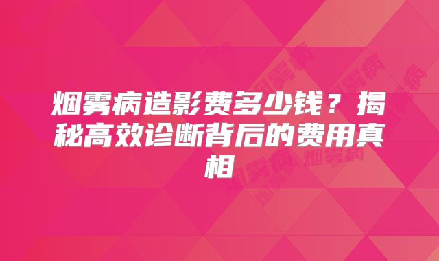 烟雾病造影费多少钱？揭秘高效诊断背后的费用真相