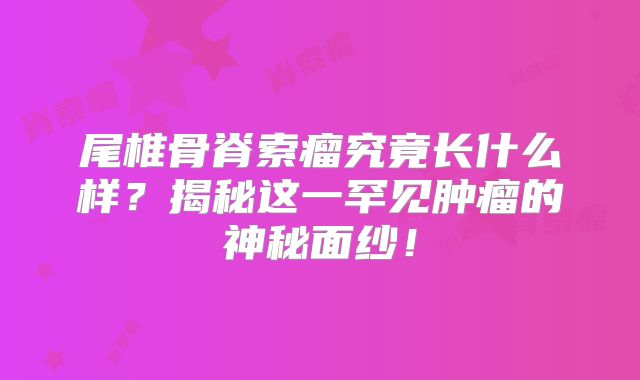 尾椎骨脊索瘤究竟长什么样？揭秘这一罕见肿瘤的神秘面纱！
