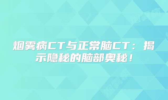 烟雾病CT与正常脑CT：揭示隐秘的脑部奥秘！
