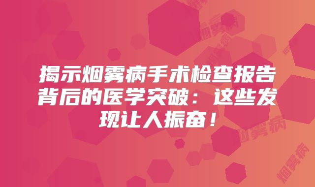 揭示烟雾病手术检查报告背后的医学突破：这些发现让人振奋！