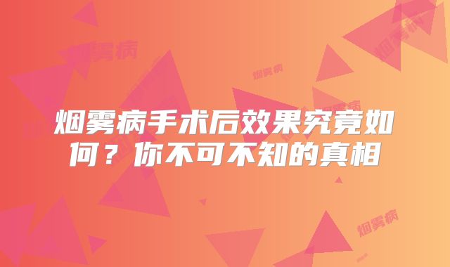烟雾病手术后效果究竟如何？你不可不知的真相