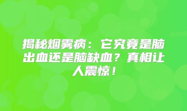 揭秘烟雾病：它究竟是脑出血还是脑缺血？真相让人震惊！