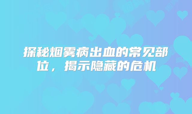 探秘烟雾病出血的常见部位，揭示隐藏的危机