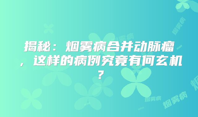 揭秘：烟雾病合并动脉瘤，这样的病例究竟有何玄机？