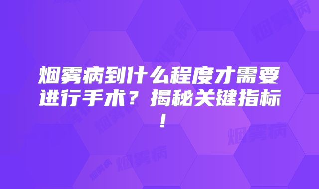 烟雾病到什么程度才需要进行手术？揭秘关键指标！
