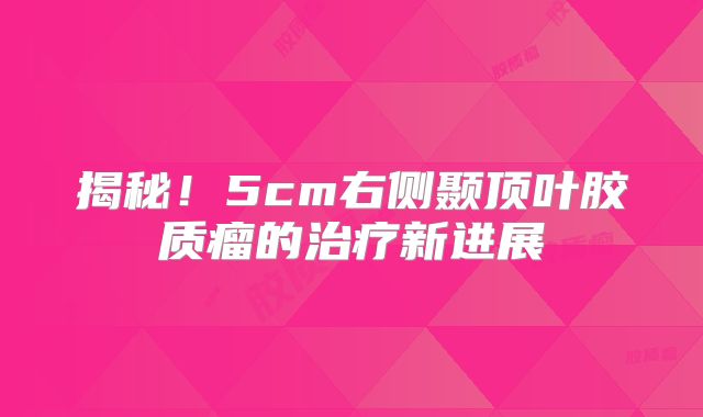 揭秘！5cm右侧颞顶叶胶质瘤的治疗新进展