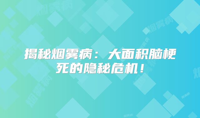 揭秘烟雾病：大面积脑梗死的隐秘危机！