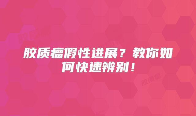 胶质瘤假性进展？教你如何快速辨别！