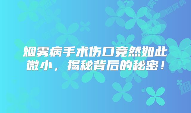 烟雾病手术伤口竟然如此微小，揭秘背后的秘密！