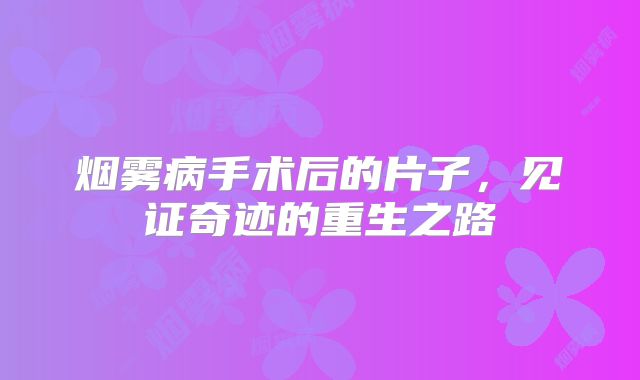 烟雾病手术后的片子，见证奇迹的重生之路