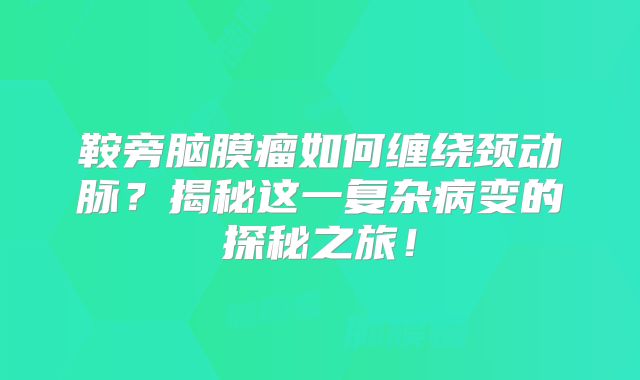 鞍旁脑膜瘤如何缠绕颈动脉？揭秘这一复杂病变的探秘之旅！