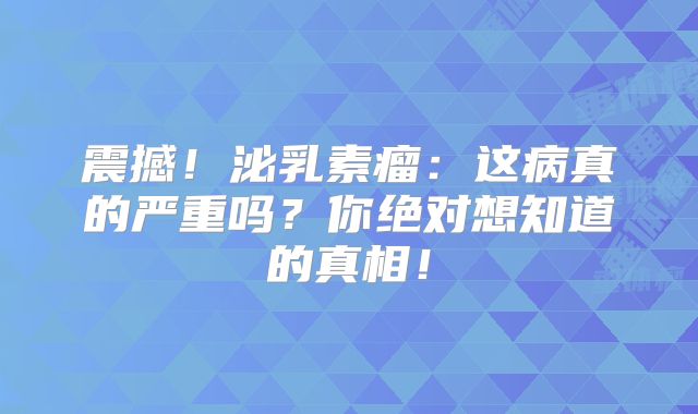 震撼！泌乳素瘤：这病真的严重吗？你绝对想知道的真相！